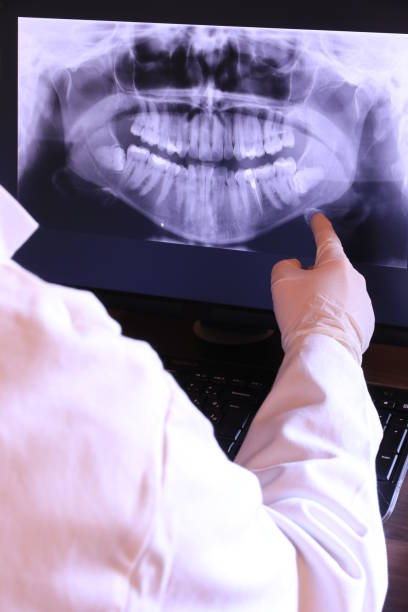 Best Emergency Treatment for Dental Infections or Abscesses in Nesquehoning, PA