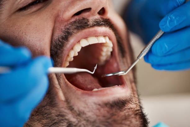 Best Emergency Dental Care for Broken or Chipped Teeth in Nesquehoning, PA