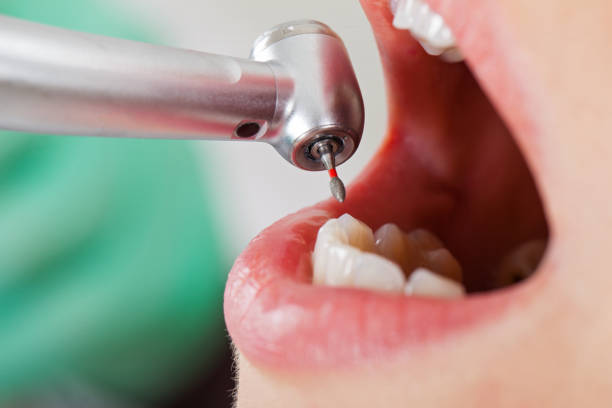 Best Emergency Treatment for Dental Infections or Abscesses in Nesquehoning, PA